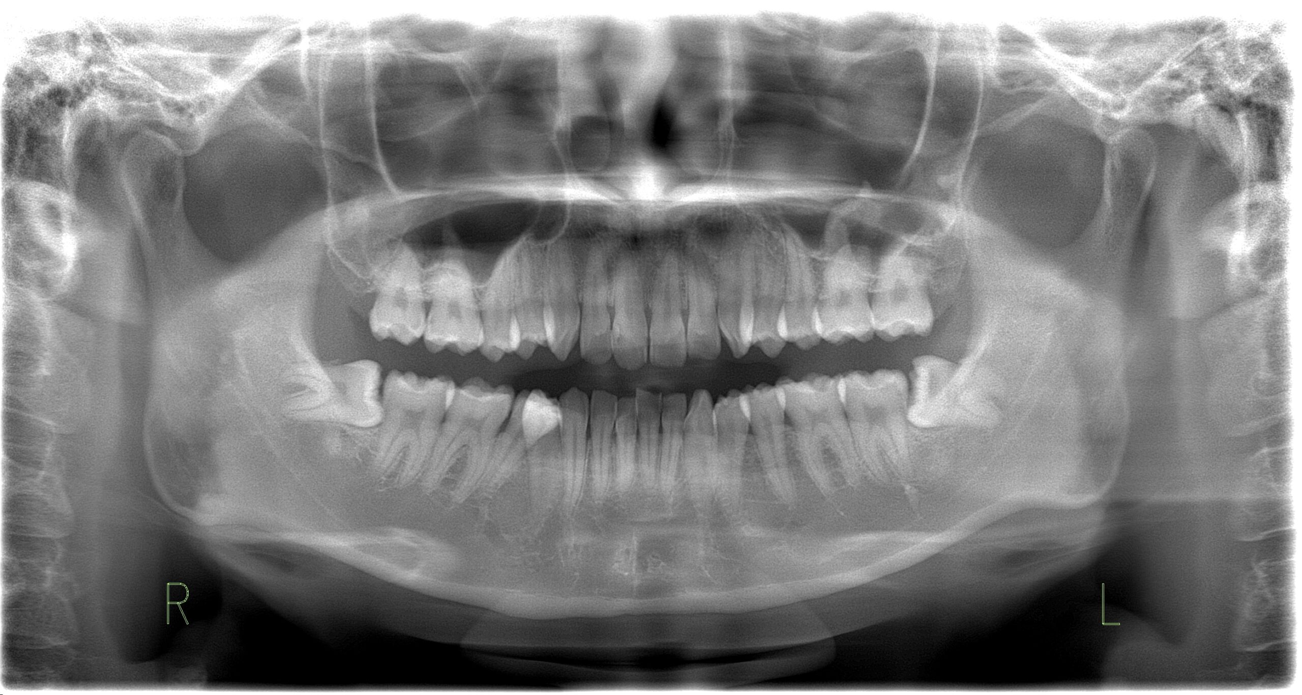 考えられる合併症